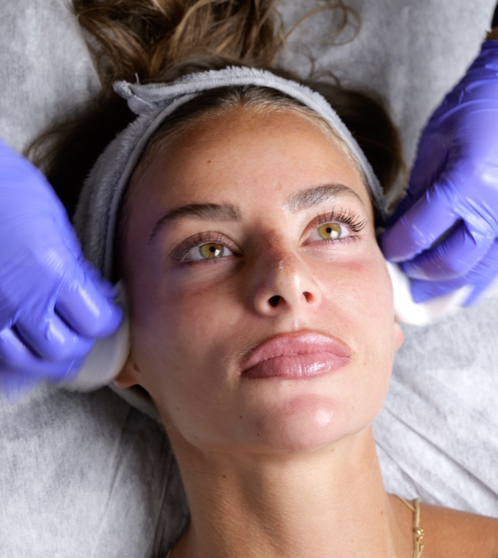 Dermapen-behandling hos Life Long Clinic i Göteborg